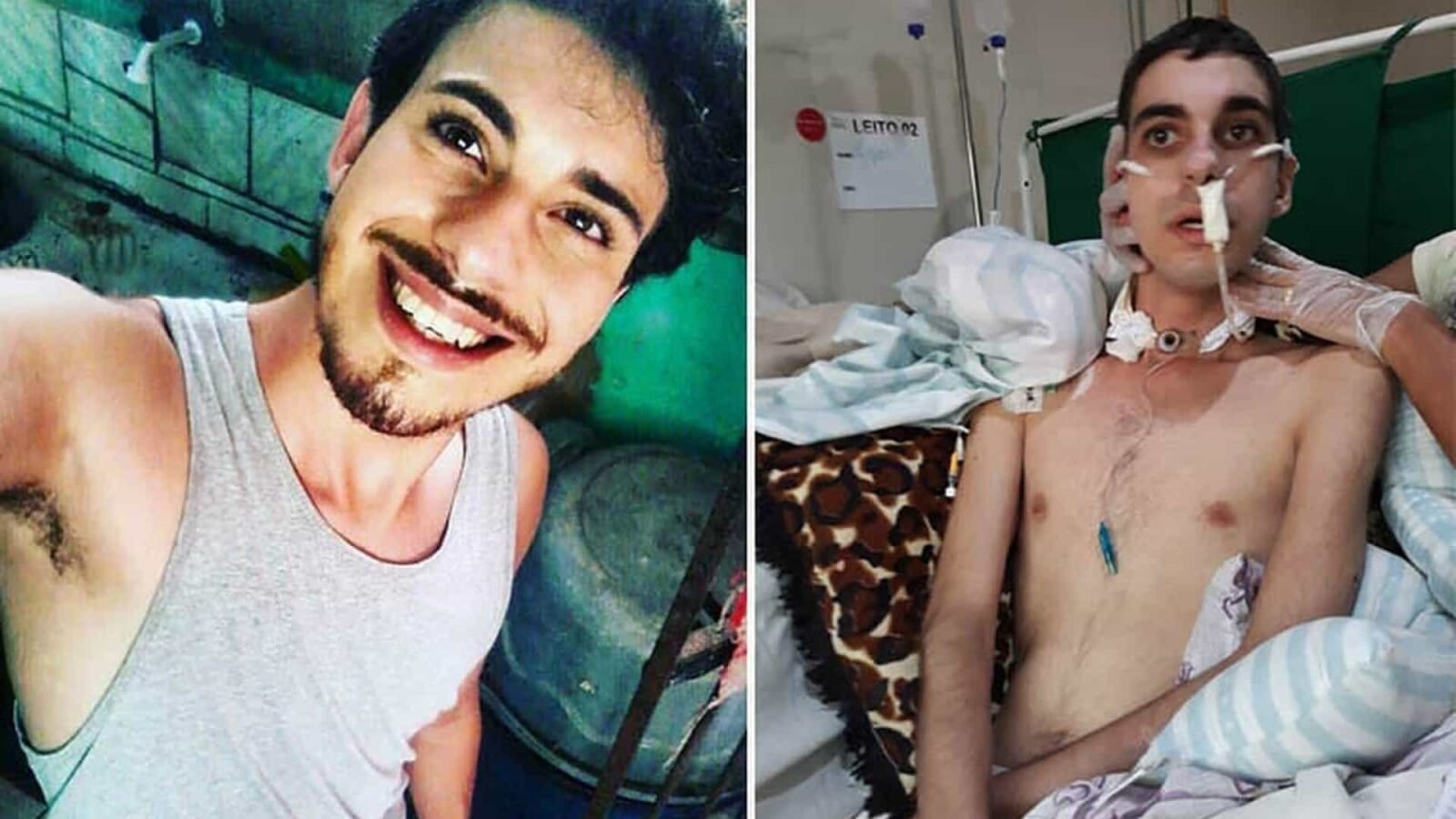 Polícia prende suspeito de brutal ataque homofóbico em PE