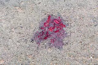 1vc1gimwhcmrp Motociclista arrastada e inconsciente após acidente em Campo Grande