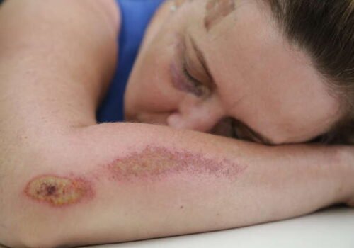 Nos primeiros dez dias do ano, quase 500 mulheres sofreram violência doméstica