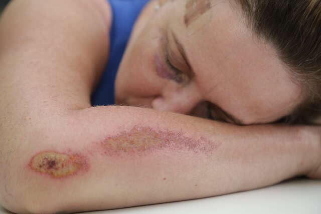 Nos primeiros dez dias do ano, quase 500 mulheres sofreram violência doméstica