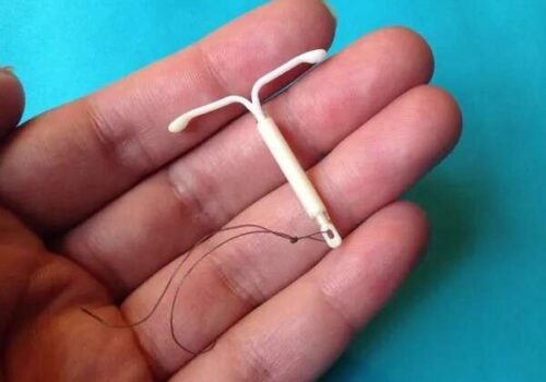 SUS amplia tratamento para mioma e sangramento intenso em mulheres