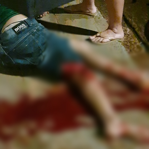 Colisão entre motos deixa jovem com fratura exposta no Campo Alto