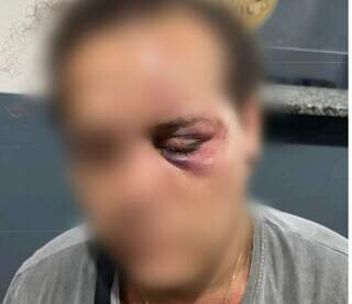 “Achei que iam me matar”, diz mulher trans espancada e marcada com suástica “Achei que iam me matar”, diz mulher trans espancada e marcada com suástica