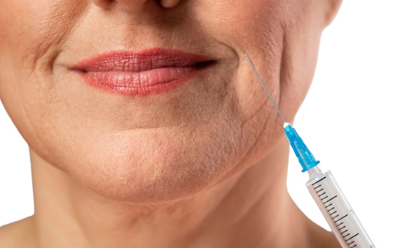 Anvisa alerta para riscos graves do uso indevido de preenchedores estéticos