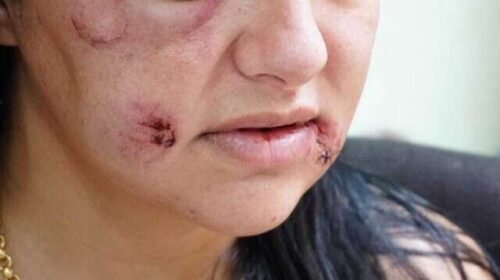 PMs começam hoje curso sobre enfrentamento à violência doméstica