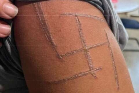 “Achei que iam me matar”, diz mulher trans espancada e marcada com suástica