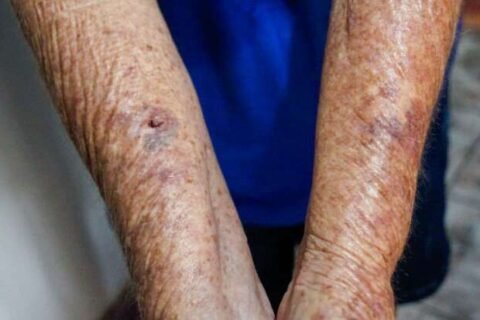 Ladrões levaram 84 mil de família e ameaçaram cortar pescoço de cão em assalto