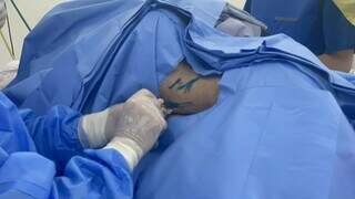 Da Capital, médico treinado aplica polilaminina em vítima de bala perdida Da Capital, médico treinado aplica polilaminina em vítima de bala perdida