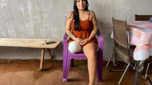 Vítima de acidente, jovem busca autonomia lutando por prótese de R$ 100 mil