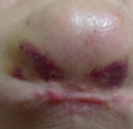 Paciente será indenizada por deformidades no rosto após cirurgias