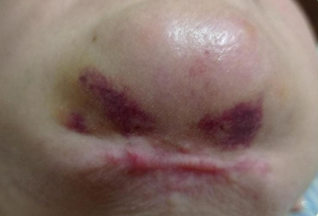 Paciente será indenizada por deformidades no rosto após cirurgias