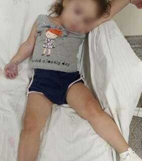 Falta de medicamento na Casa da Saúde afeta criança com doença nos rins