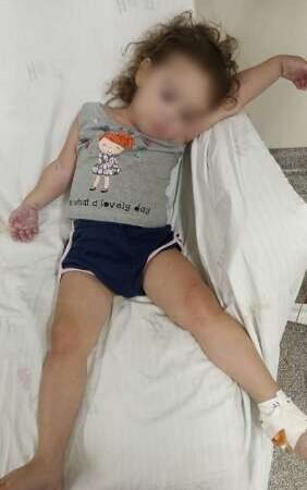 Falta de medicamento na Casa da Saúde afeta criança com doença nos rins