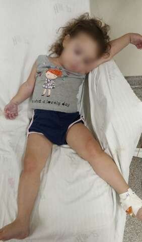 Falta de medicamento na Casa da Saúde afeta criança com doença nos rins