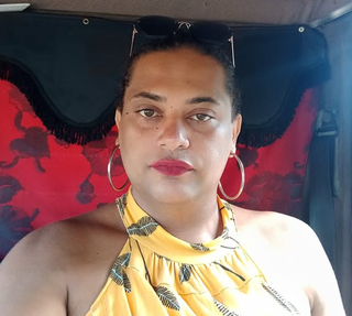 Secretária do PT fica em estado gravíssimo após acidente entre moto e caminhão