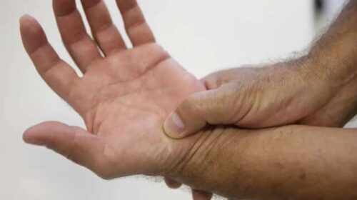Mesmo com leis, pacientes com fibromialgia enfrentam entraves no acesso ao INSS