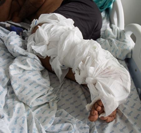Espera por cirurgias cria "fila invisível" de pacientes na Santa Casa