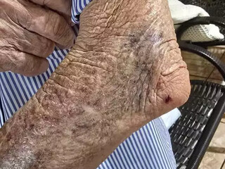 Cachorro derruba e morde idoso de 87 anos a caminho do mercado na Vila Nasser