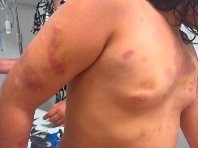 Em áudio, mãe de autista agredida diz que padrasto era "figura de pai"