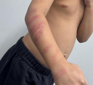 Padrasto é preso em flagrante por espancar menino de 5 anos com galho de amora
