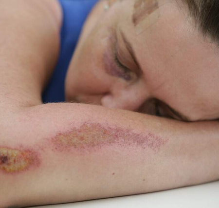 Pena por agressão a médicos e professores pode dobrar em nova lei