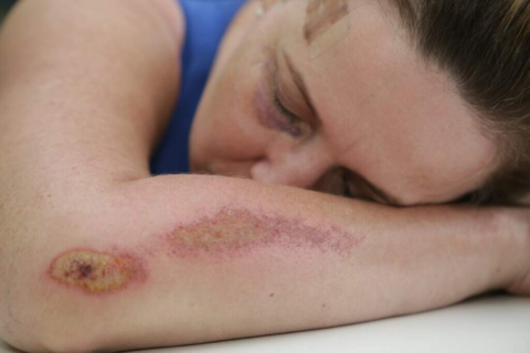 Pena por agressão a médicos e professores pode dobrar em nova lei