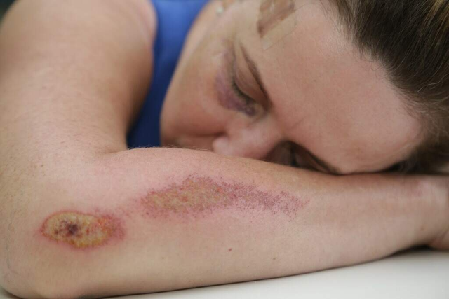 Pena por agressão a médicos e professores pode dobrar em nova lei
