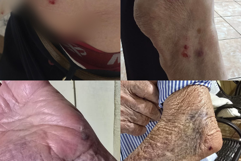 Cachorro derruba e morde idoso de 87 anos a caminho do mercado na Vila Nasser