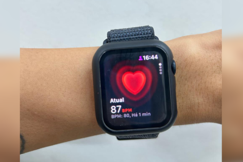 Monitoramento contínuo no pulso: até onde os alertas dos wearables preocupam?