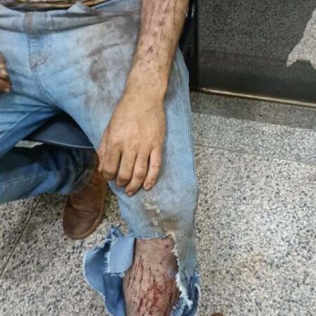 Jovem relata ataque de onça enquanto trabalhava em colheitadeira em área rural
