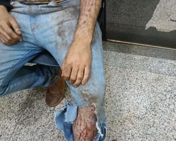 Jovem relata ataque de onça enquanto trabalhava em colheitadeira em área rural